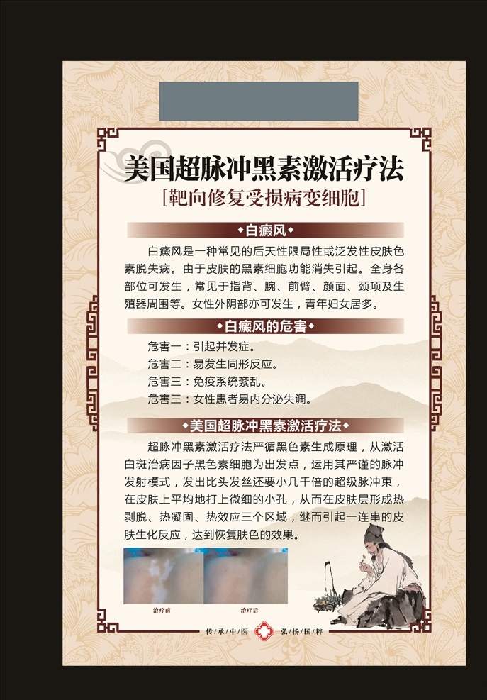 白癜風掛圖 皮膚科掛圖 展板 中藥 中醫(yī)科 白癜風 廣告 院內 皮膚科