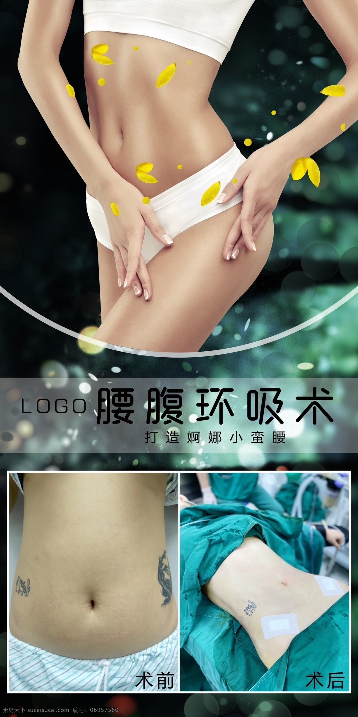 对比图图片 整形美容专题 活动专题 面部填充 整形美容 整形广告 美容 整形app 整形活动 整形电商 新氧广告 新氧整形 新氧美女 医美对比图 医美海报 美容海报 对比图 医美案例对比 医美 案例对比 整形 整容 整形对比 对比照 案例 对比 术前 术后 手术 医疗美容 简洁 小清新 浅色 绿色 减肥