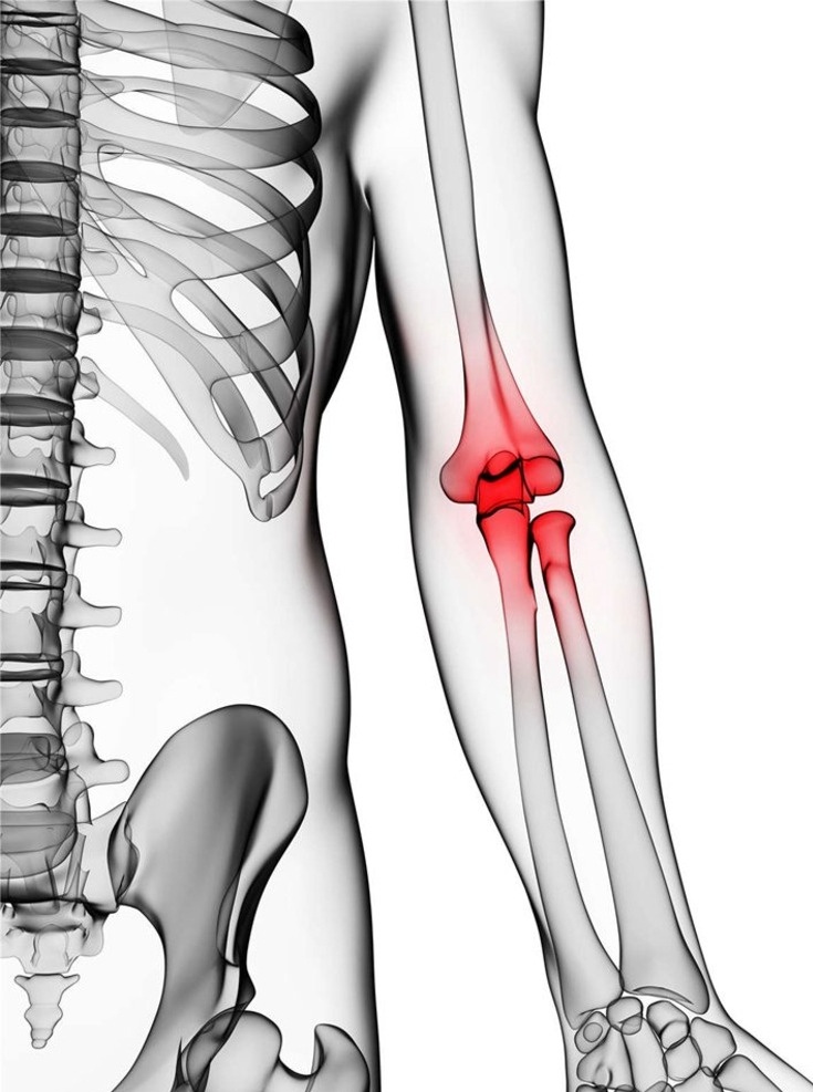 关节 肘部 人体 人体器官 人体组织 人体结构 医学 医疗 科学 医疗护理 现代科技