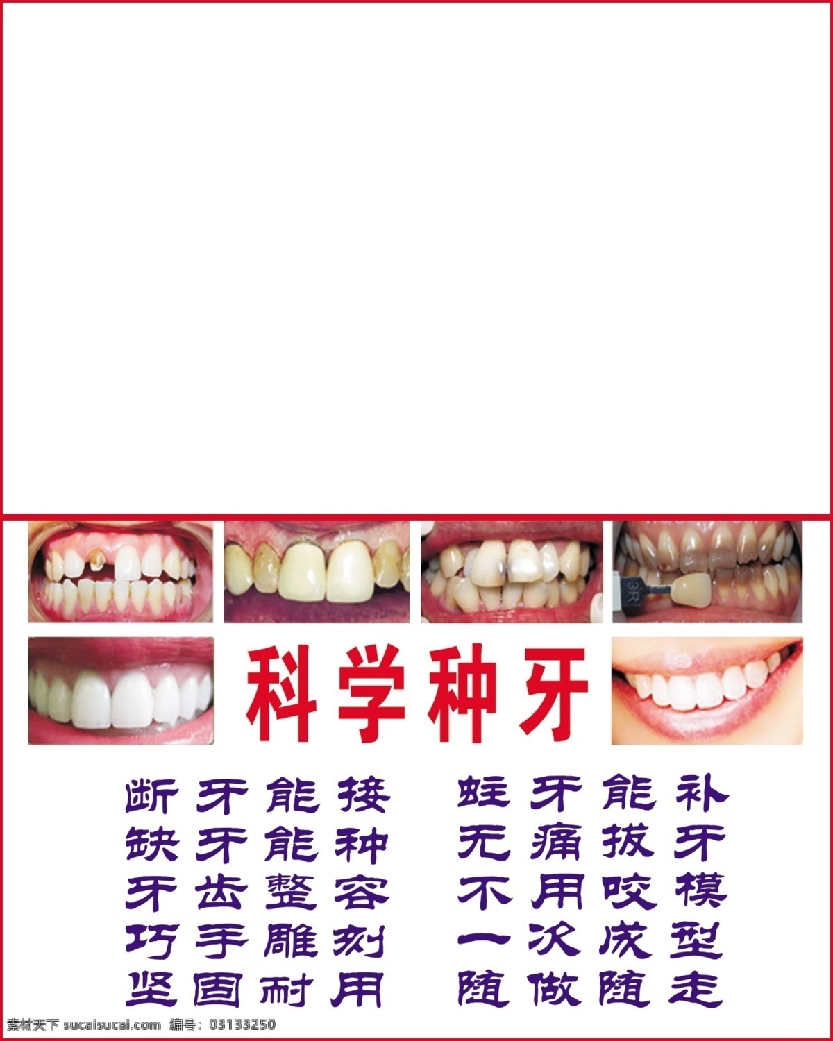 种 牙 广告设计模板 其他模版 牙齿 牙科 源文件 种牙 科学种牙 恶心的牙齿 断牙 蛀牙 缺牙 矢量图 现代科技
