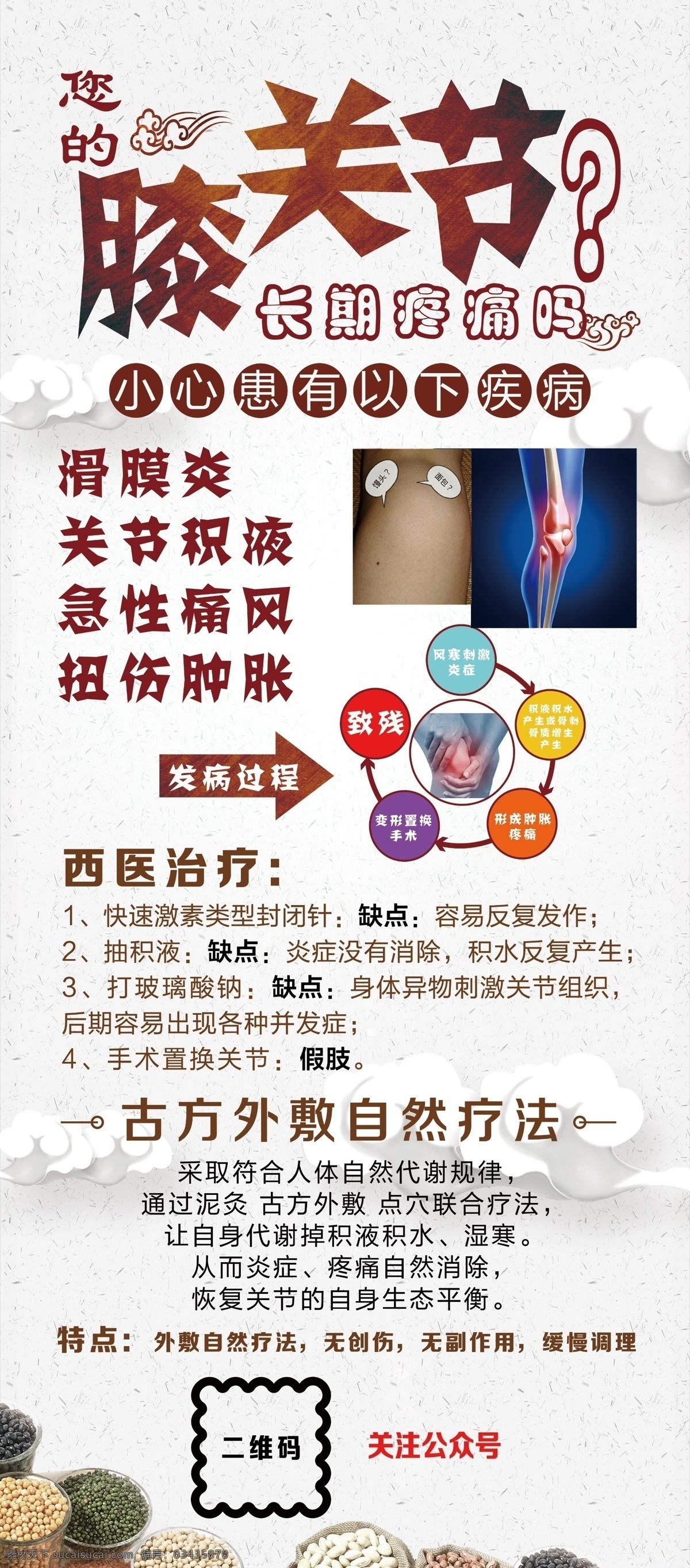 漆关节 滑膜炎 关节积液 急性痛风 扭伤肿胀 中医 展架 中医展架 膝关节 展板模板
