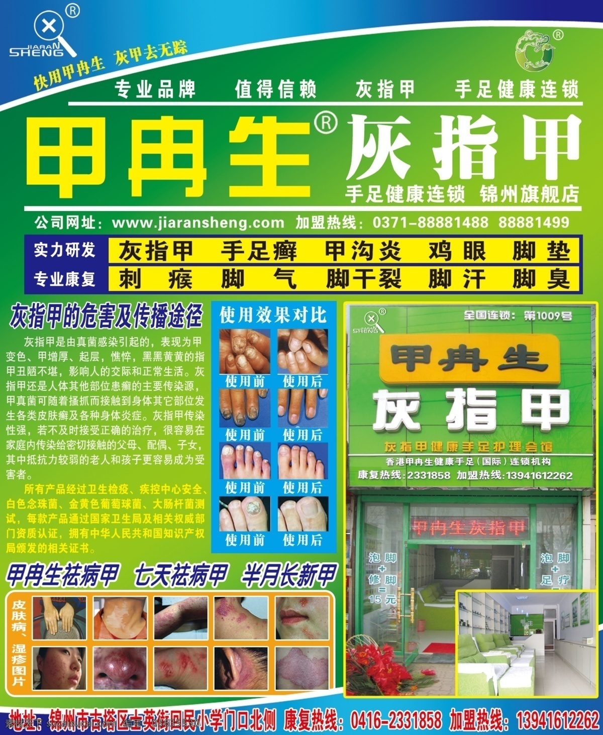 甲冉生 灰指甲 对比图 门脸 背景 标志 绿色背景 dm宣传单 广告设计模板 源文件