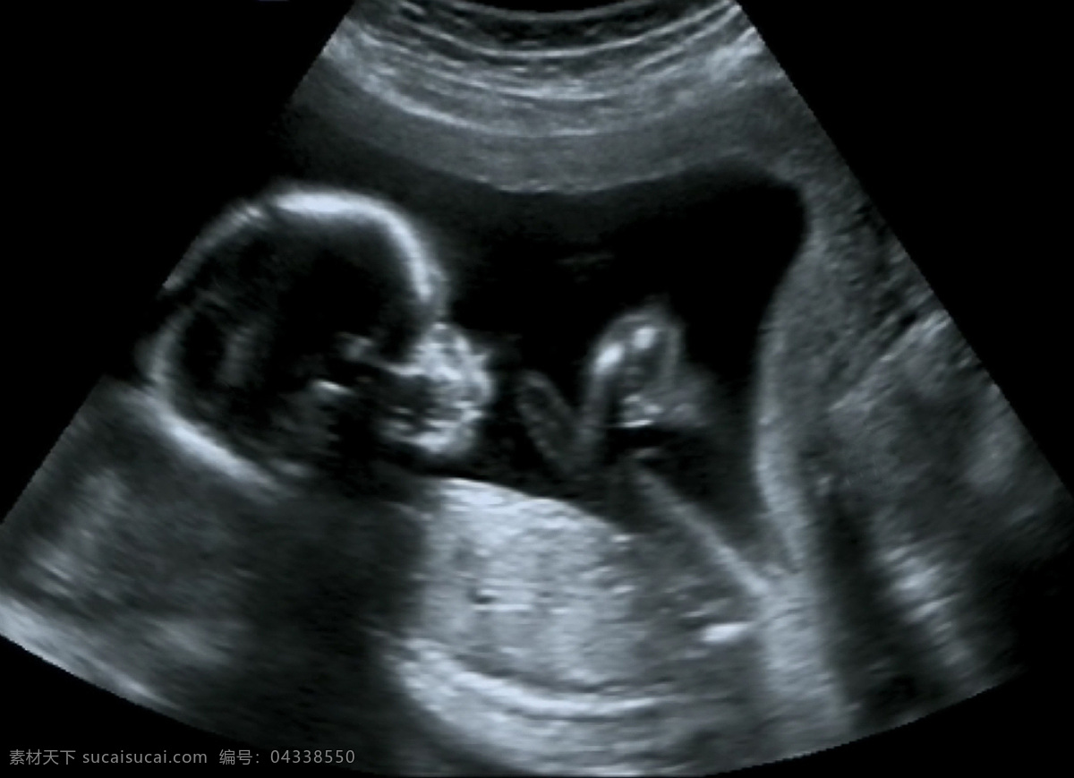 超声波 里 胎儿 孕妇 准妈妈 怀孕女性 医生 b超 医疗卫生 医疗服务 医疗护理 现代科技