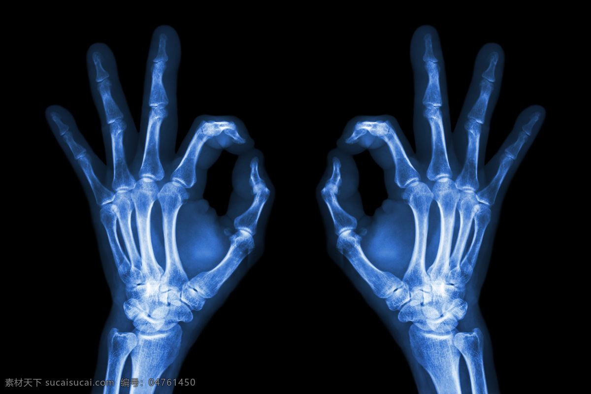 手 x 光 片 图 医疗护理 医学研究 x光片 x光片图片 医疗 拍片 医学研究素材 护理 图片库 光片 轮廓 透视 医用 结构 骨骼 现代科技