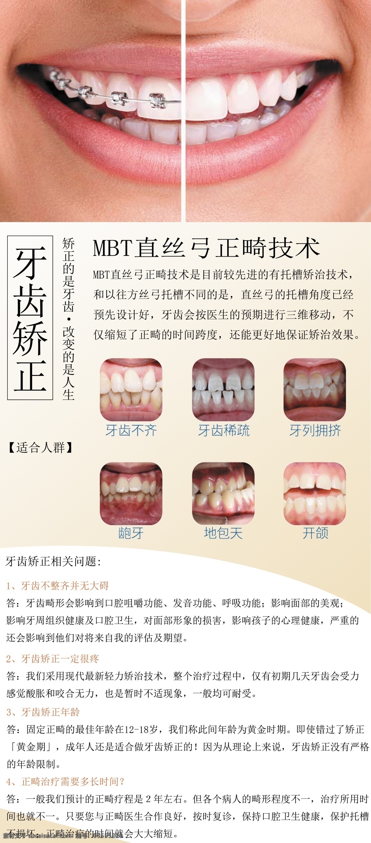 牙齿矫正 mbt矫正 牙齿正畸 牙齿矫正展架 牙齿 分层 背景素材