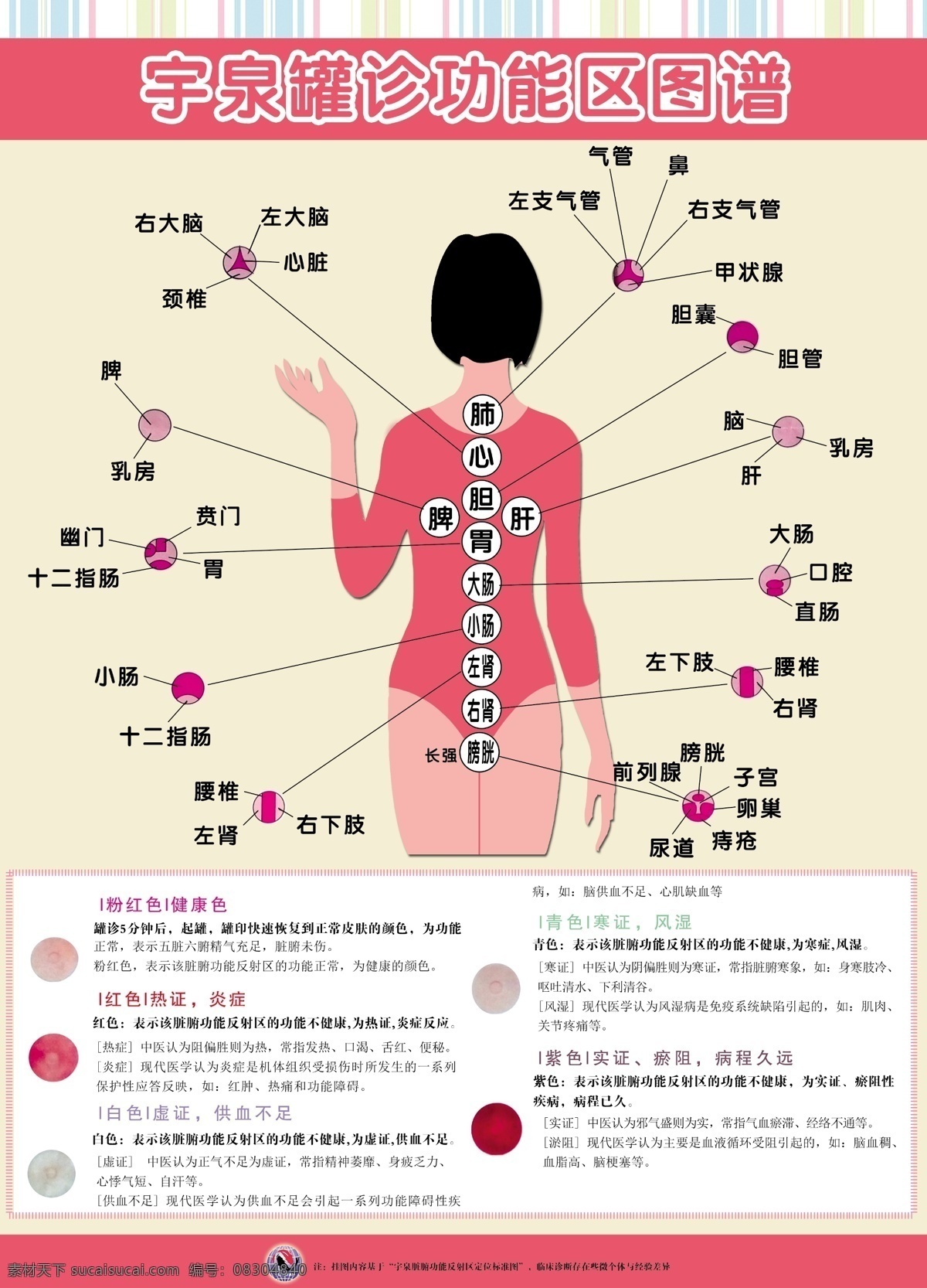 宇泉罐功能区 拔罐 罐象 宇泉 拔罐的作用 疗效 分层