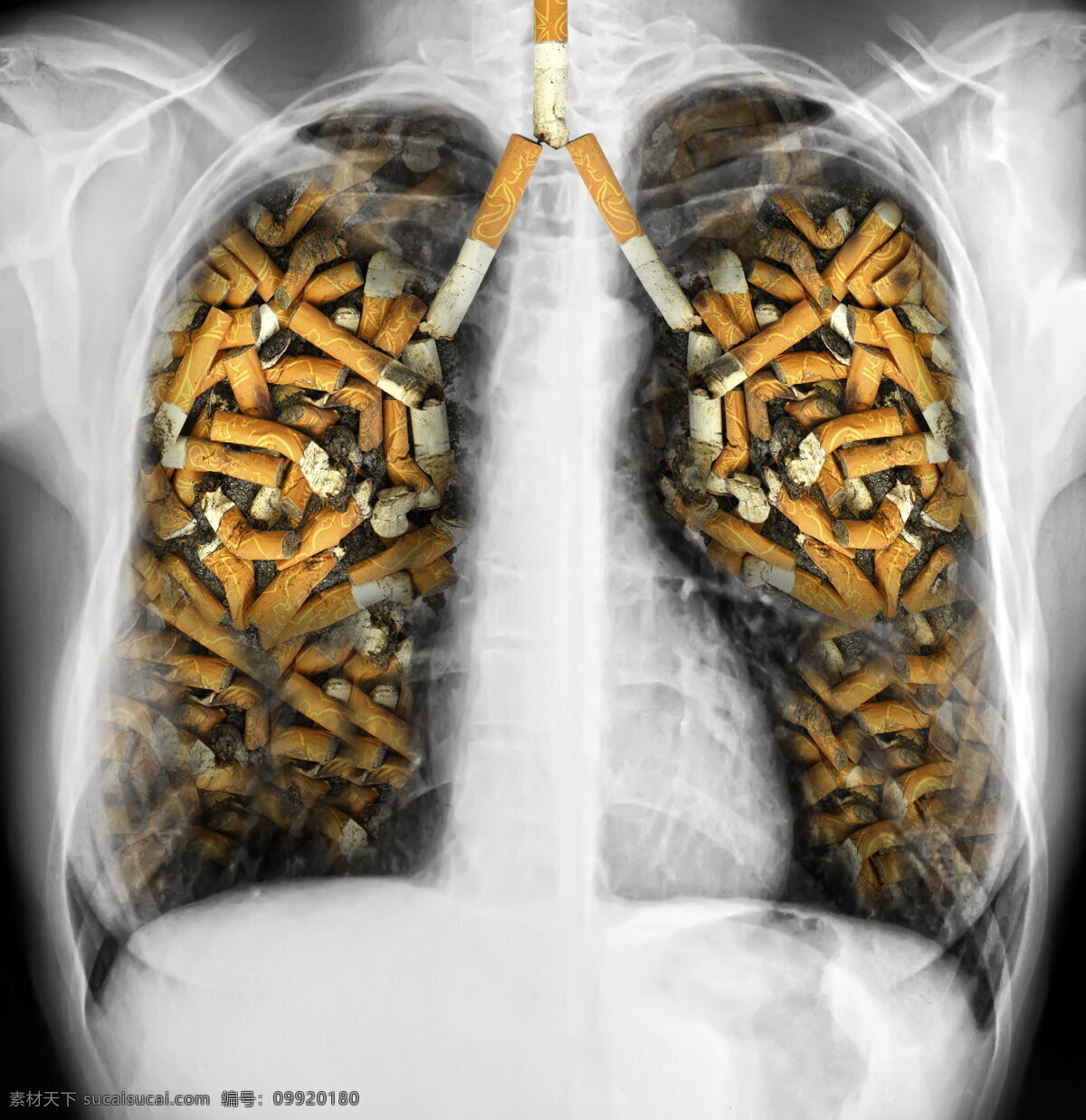 禁烟 广告 高清 吸烟 香烟 肺部 肺 黑白