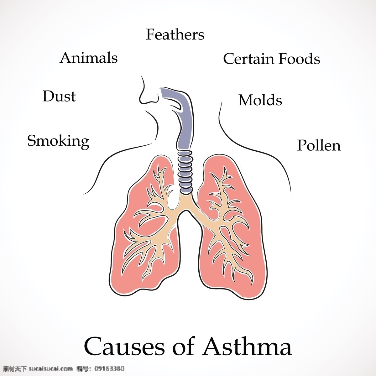 哮喘 矢量 世界 日 原因 动物 吸烟 羽毛 导致哮喘 某些食物 一天 灰尘 花粉 霉菌 哮喘的世界 世界哮喘日 矢量图 其他矢量图