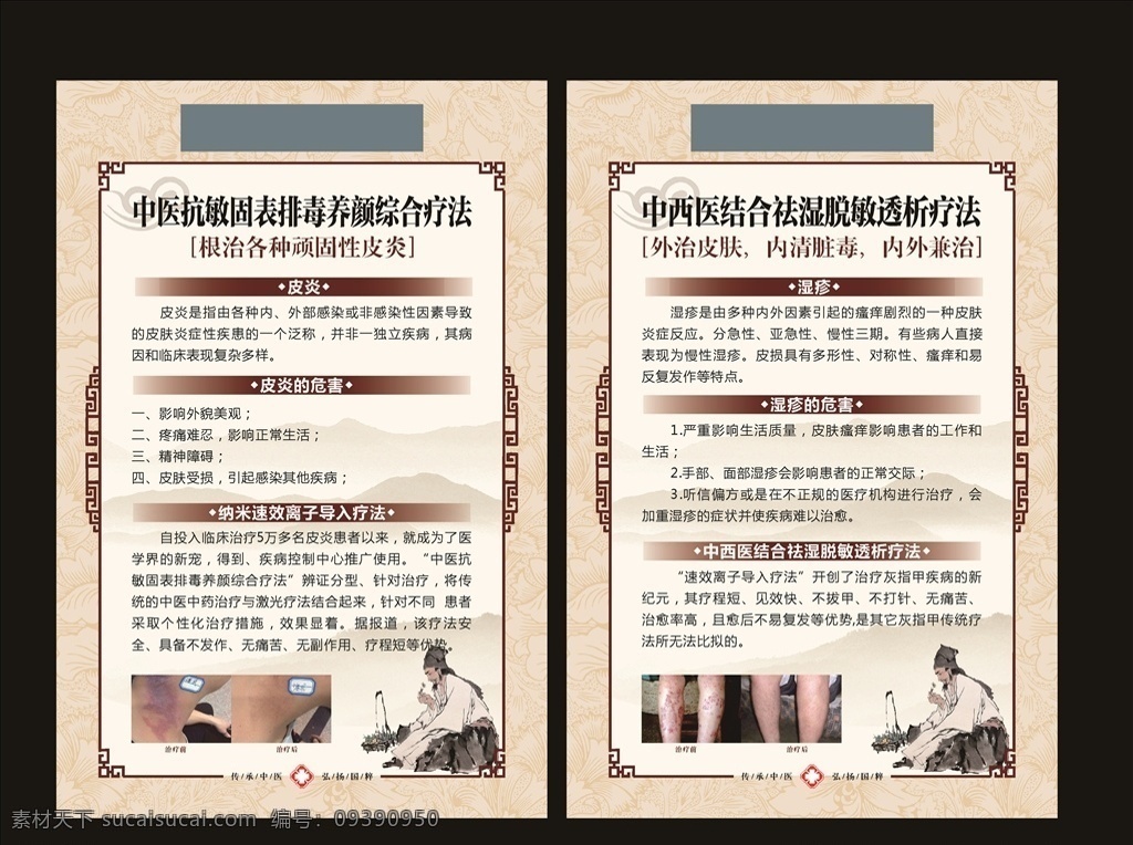 皮炎 湿疹 皮肤科 挂图 展板 皮肤科挂图 中医科 广告 院内