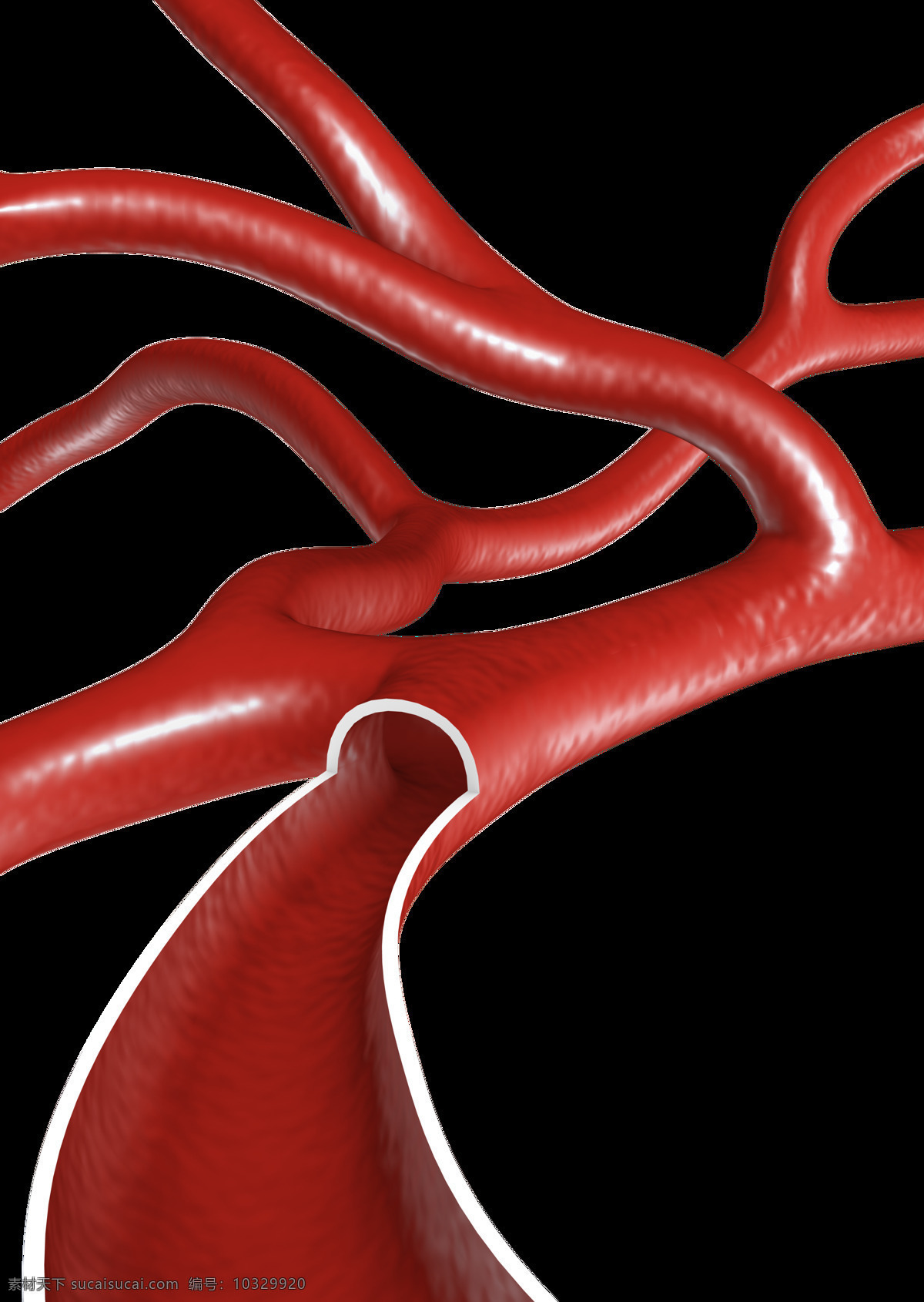 医用血管 血管 医用 插图 透明 背景 3d设计 3d作品
