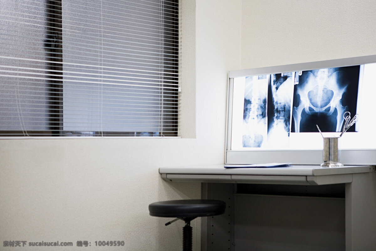 医院 办公室 里 x 光 片 医疗 x光片 医院素材 特写 摄影图 高清图片 医疗护理 现代科技