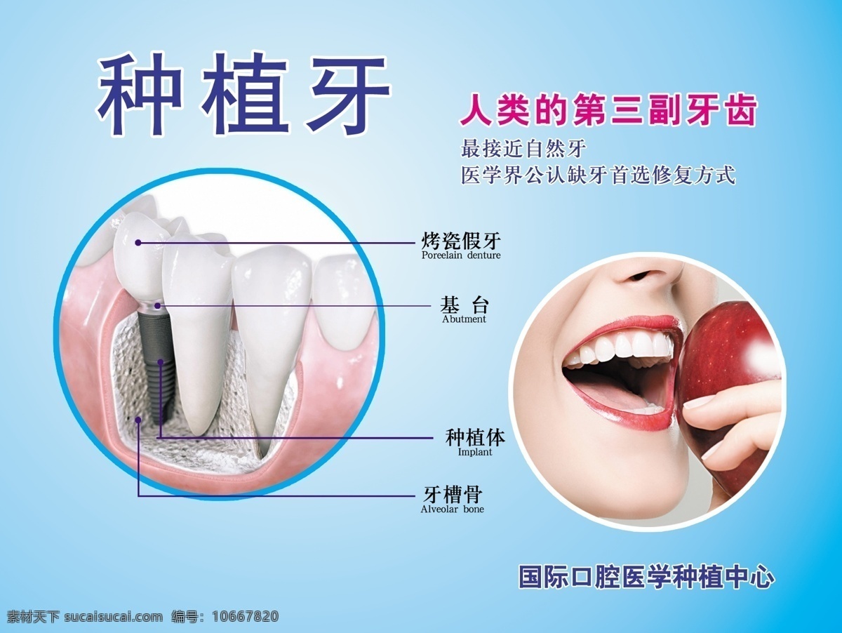 种植牙 吃苹果 口腔中心 牙齿结构 口腔门诊 分层