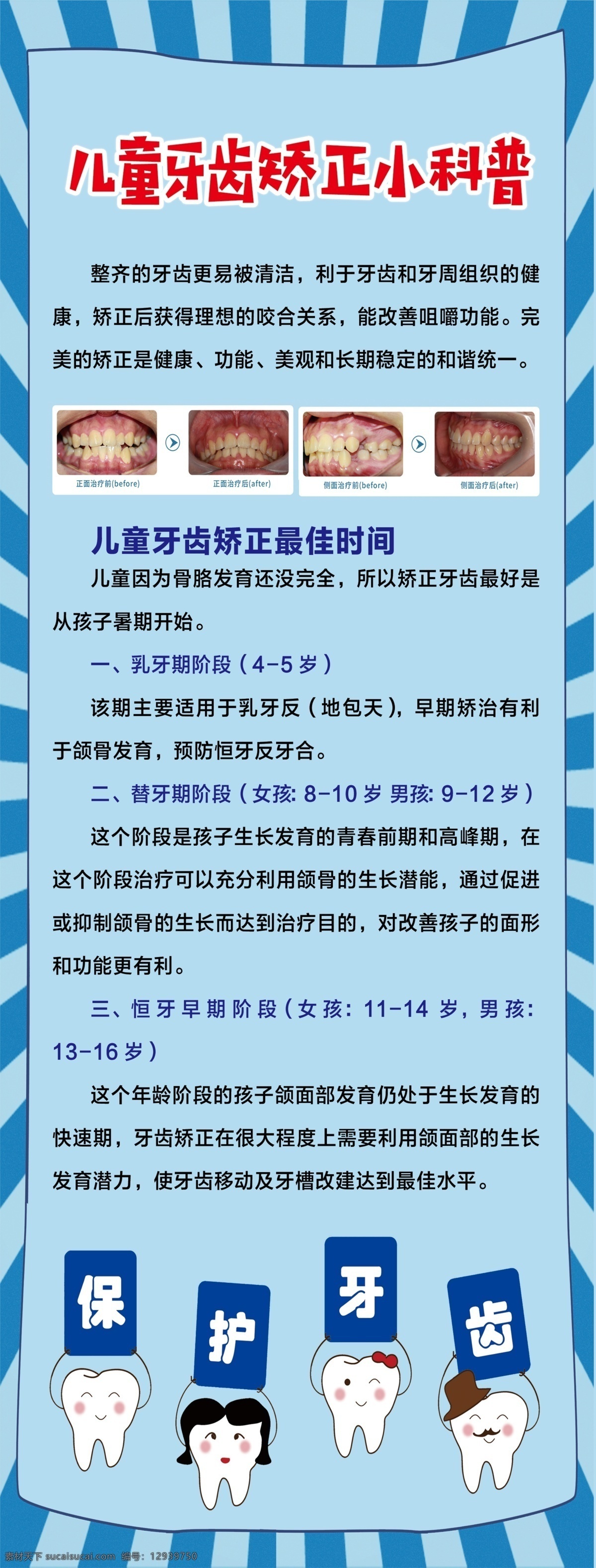 牙齿矫正图片 矫正牙齿 正畸 矫正 龅牙 龅牙矫正 自锁托槽 隐形矫正 隐形矫正牙齿 牙齿隐形矫正 正畸牙齿 金属托槽矫正 陶瓷托槽矫正 快速矫正 牙齿正畸 美容修复 牙科 口腔 医院 广告海报 口腔美容 牙齿美容 口腔海报 牙科海报 牙齿广告 矫正广告