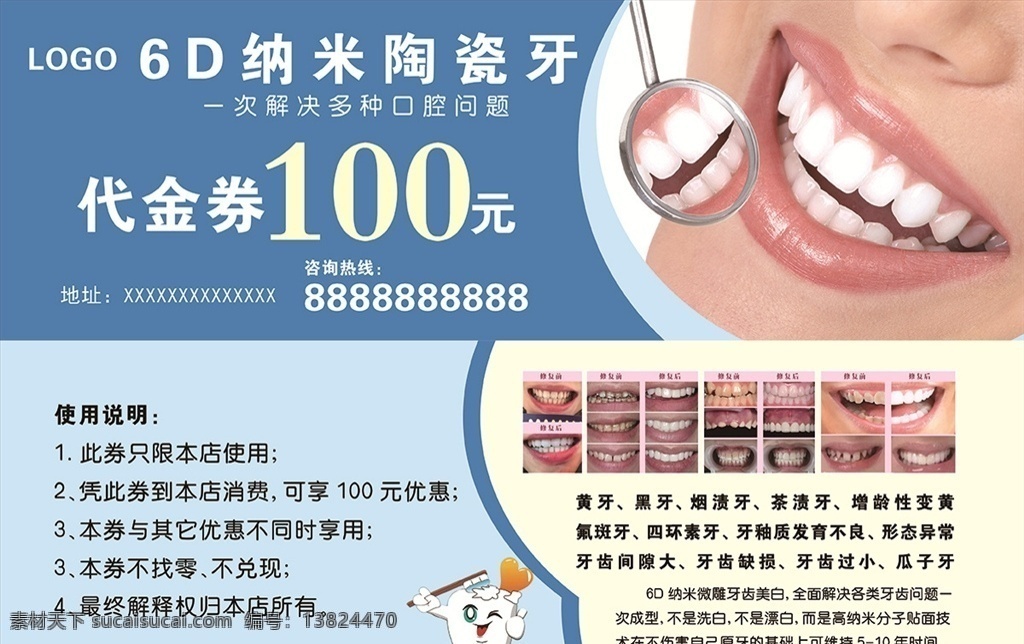 6d 纳米 陶瓷 牙 代金券 纳米陶瓷牙 纳米美牙 美牙 分层
