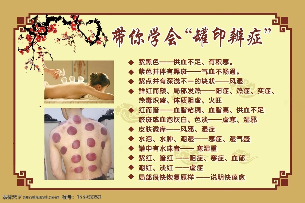 罐印辩证写真 罐印辨证 罐印 各种罐印 罐印图 罐印海报 罐印简介