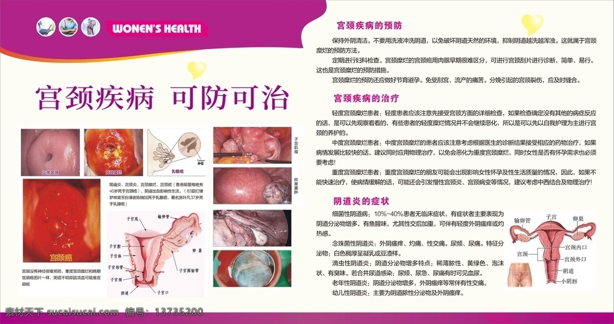 宫颈疾病 可防可治 妇科 妇科医院 品牌妇科 精品妇科 专业妇科 妇科宣传单 妇科海报 妇科广告 妇科宣传 妇科传单 妇科画册 妇科医院海报 妇科医院广告 医院妇科 女子以血为本 修正药业 展板模板