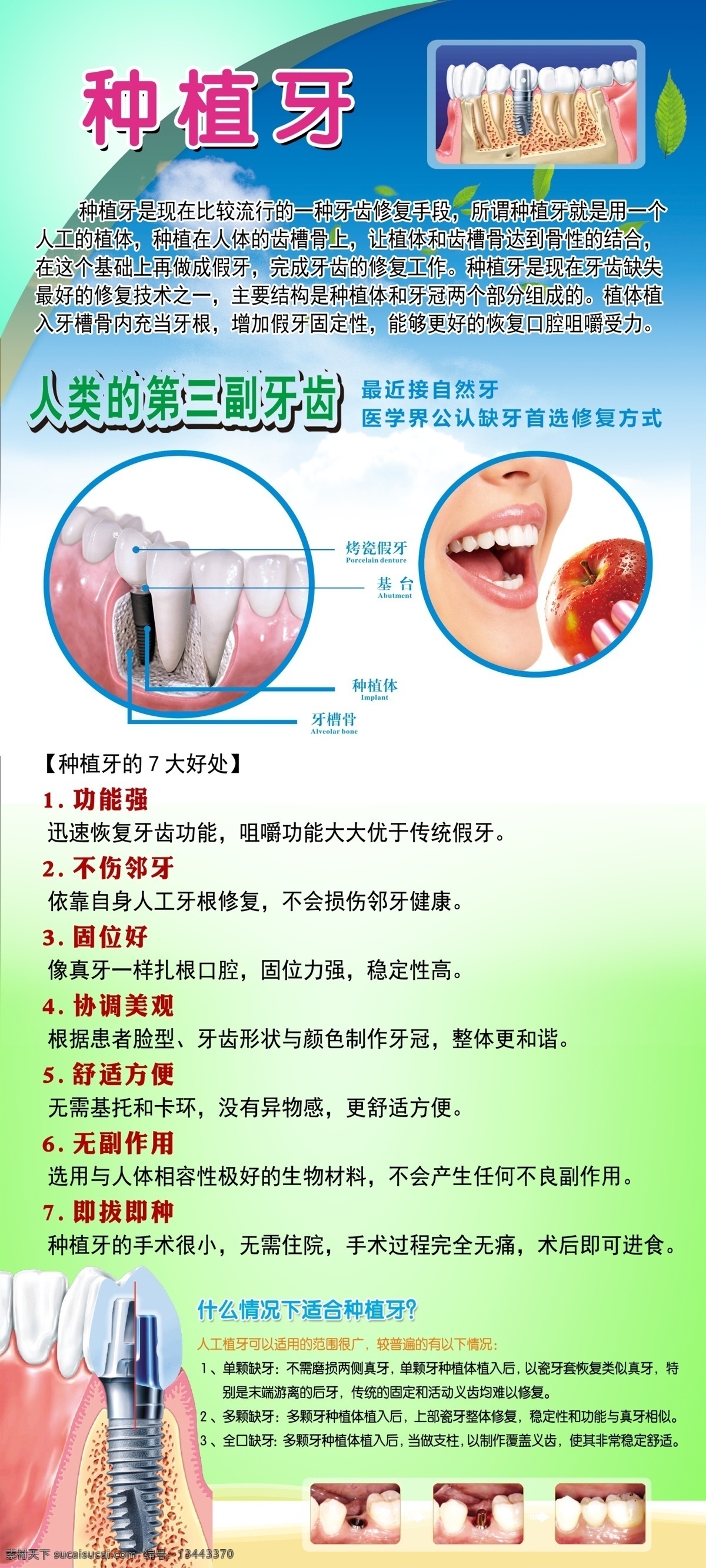 种植牙广告 牙齿 牙科广告 牙齿展架 牙科展架 种植牙 展板模板