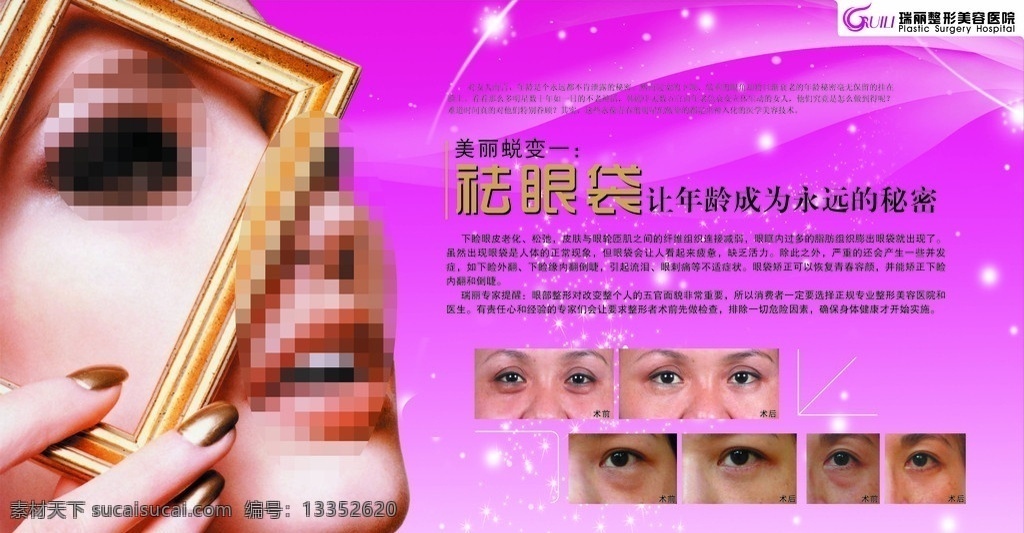 袪眼袋海报 袪眼袋 明星 水珠 水泡 泡泡 焕肤 美疗 海报 眼睛 双眼皮 美肤 整形 美容 肌肤 医院 皮肤 展示 展板 模板 展架 矢量广告模板 展板模板 矢量