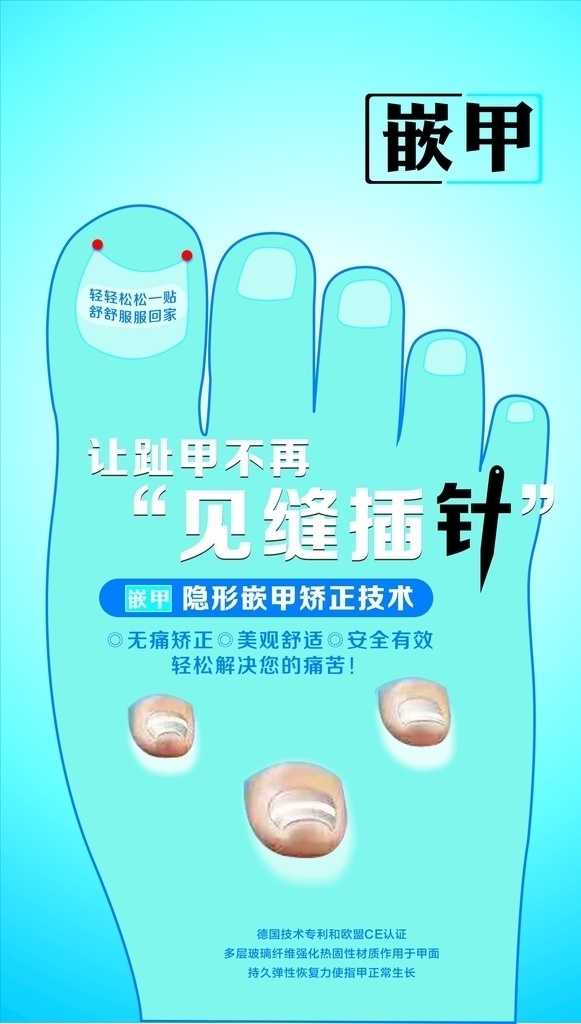 世龙世家嵌甲 世龙世家 嵌甲 见缝插针 灰指甲 嵌甲技术